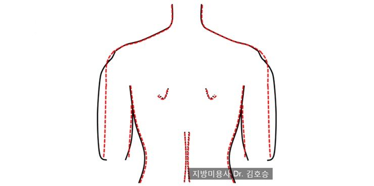 당신의 팔, 날씬하게 만들어주는 운동 팁!