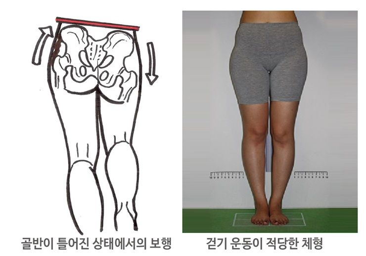 운동이 독이 되는 하체비만 유형은?!