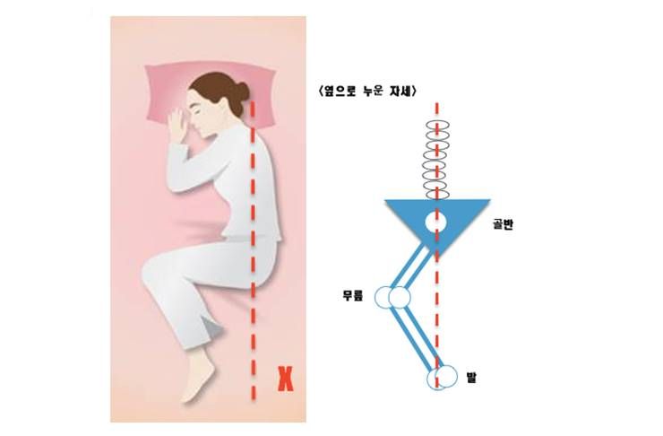 당신의 골반과 고관절, 안녕한가요?