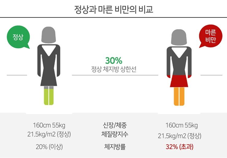 날씬한데 배만 볼록한 `마른비만`?